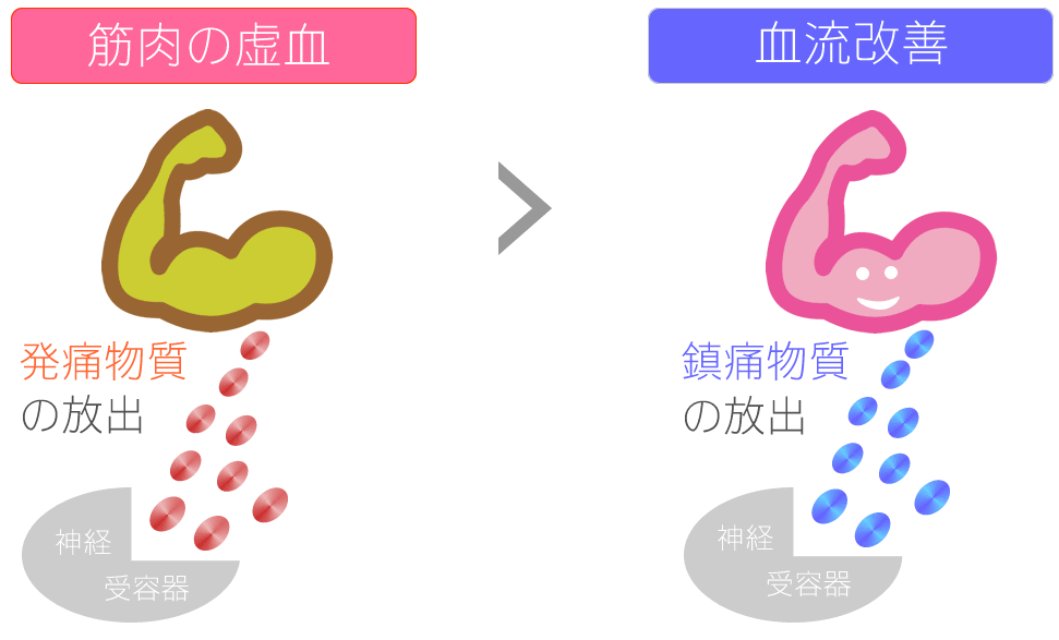 トリガーポイント トリガーポイントイメージ?